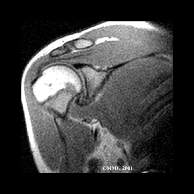 Adesivo Capsulis Imagem 2 Adesivo Capsulis Imagem 2