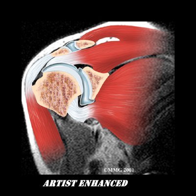 Adesivo Capsulis Imagem 3 Adesivo Capsulis Imagem 3